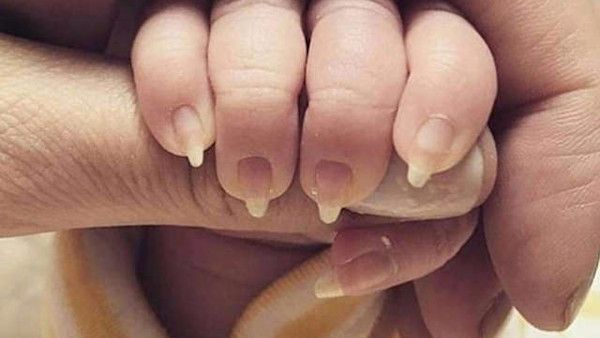Zrobila manicure niemowleciu